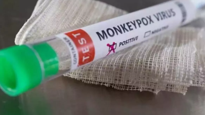 Maymun çiçeği virüsü bir ülkede daha görüldü