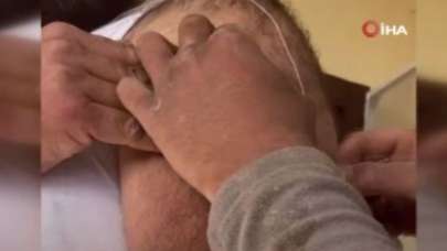 Koluna yapışan keneyi bakın neyle çıkardı!