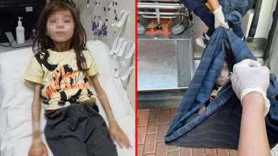 9 yaşındaki Muhammet'i çöp evde kilitli tutan teyzesinin ilk ifadesi ortaya çıktı