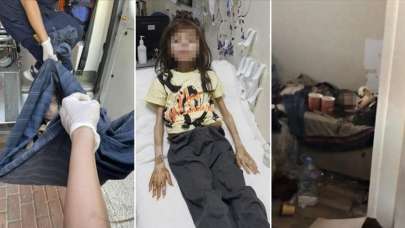 Çöp evde bulunan çocuk hakkında önemli gelişme!