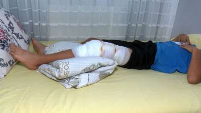 Çocuk parkında bir pitbull saldırısı daha! 'Köpeği üstüme saldılar'