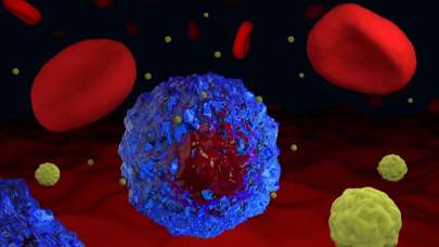 Bu bölgede ağrı hissediyorsanız dikkat! Üç ölümcül kanser türünün belirtisi...