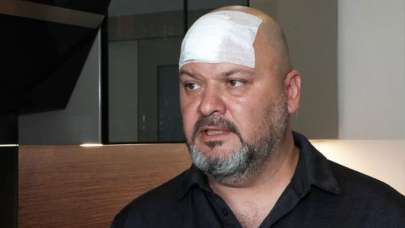 100 bin lira kirayı reddetti! Kiracıya beyzbol sopalı saldırı