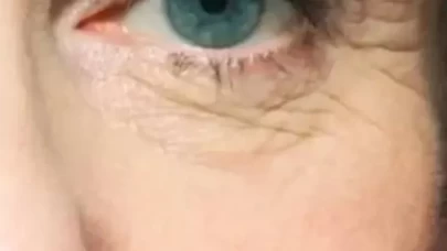 Ciltteki ince çizgileri gözle görülür şekilde azaltıyor