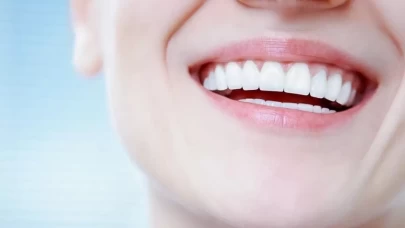 Porselen gibi dişler için inanılmaz formül: Damla sakızı etkisi!