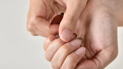 Hem Saç Hem Tırnak İçin Güçlü Çözüm: Kırılmalara Son Veren Yağ