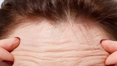 Cilt yenileyen turşu! Kırışıklıklar tarihe karışıyor