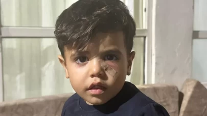 Yorgun mermi çocuğun gözünün altına isabet etti