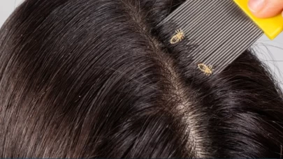 Sebebi bakın neymiş