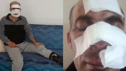 Elazığ’da eniştesine araçla çarptı, havaya fırlattı! Dehşet anları kamerada