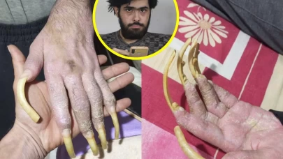 Hatay’da sanal dünyaya hapsolan genç: “Tuvalete bile mecburen gidiyorum”