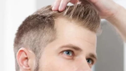 Saç ekiminden sonra bunlara dikkat etmezseniz pişman olabilirsiniz