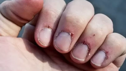 İşte en önemli 5 sebebi