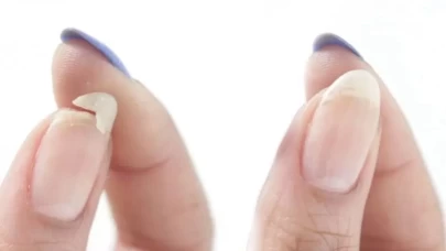 Kırık tırnaklara son! Bu mucize formülle tırnaklarınız eskisinden bile güçlü olacak!
