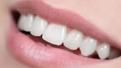 Beyaz dişler için herkesin bilmesi gereken 8 gerçek