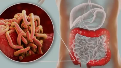 Hamilelikte Kıl Kurdu: Bebeğe Risk Oluşturur mu?