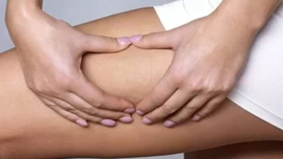 Selülitleri yok eden 6 basit egzersiz