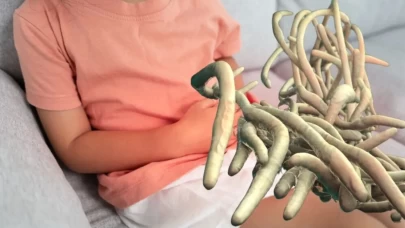 Doğal tedaviyle 10 günde kurtulun