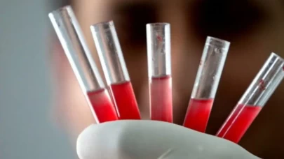 Sen de onlardan biri misin?