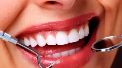 Diş taşlarını doğal yolla yok ediyor