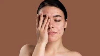 Dermatologlara göre 9 büyük hata!