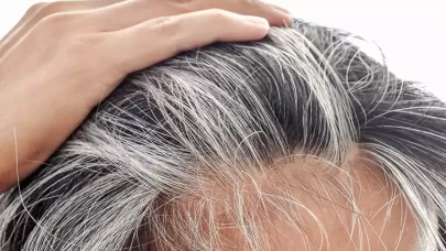 Saç beyazlamasını önlemenin 7 etkili yolu