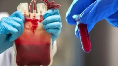 Bilim Dünyasını Şaşırtan Nadir Kan Grubu