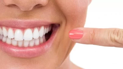 Dişleri beyazlatmanın en doğal ve kolay yolu