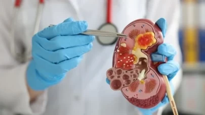 İşte Evde Uygulanabilecek Doğal Reçeteler