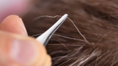 Beyaz saçı koparmanın sonuçları şaşırtıyor