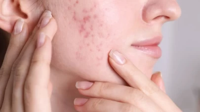 Evde yapılan bitkisel serumla ışıldayan cilt