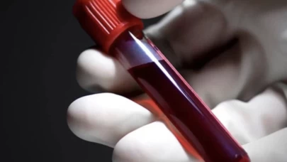 A Rh+ kan grubu olanlar daha çok mu hastalanıyor?