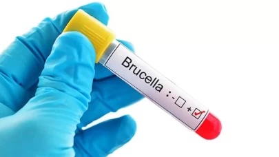Bruselloz hastalığıyla mücadelede yeni dönem başladı!