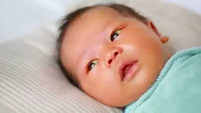 Bebeklerde Sarılık Nedir? Neden Olur ve Nasıl Tedavi Edilir?