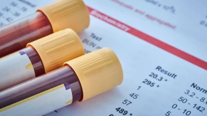 Kanda protein yüksekliği neden olur?