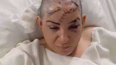 Nevşehir'de dehşet! Eski eşi satırla saldırdı