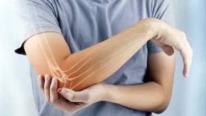 Sürekli Dirsek Üstünde Durmak Zararlı mı? Dirsek ve Bilek Sağlığınızı Nasıl Koruyabilirsiniz?