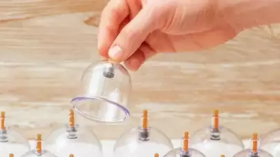 Şubat 2025 Hacamat Günleri ve Faydaları: Hacamat Ne Zaman Yapılır?