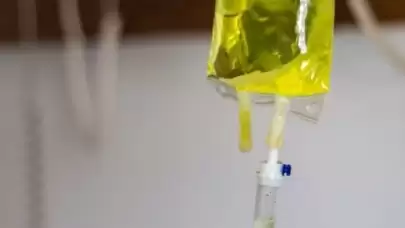 Sarı serum nedir? Ne için kullanılır? İşte detaylar!