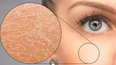 Kışın cildinizi koruyacak 10 etkili yöntem