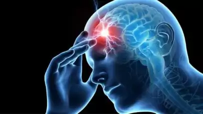 Migren Nedir? Belirtileri, Nedenleri ve Tedavi Yöntemleri