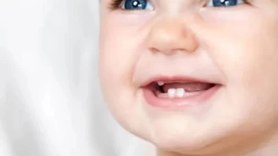 Bebeklerde diş ağrısına iyi gelen doğal yöntemler