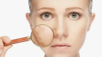 Bir damlasıyla yüzdeki kararmaları önleyen karışım!