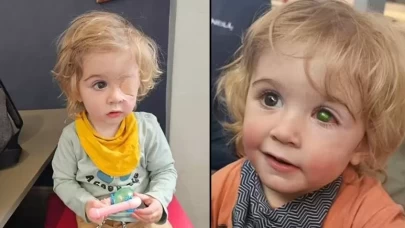 Bir öpücük yüzünden kör oldu!