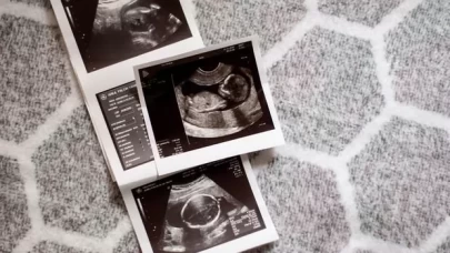 Ultrason terimleri ne anlama geliyor?