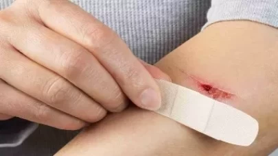 Açık yaraya kolonya dökülür mü?