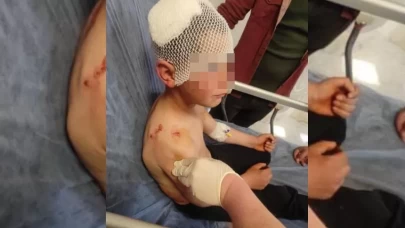 Isparta’da sokakta oynayan çocuğa başıboş köpek saldırdı