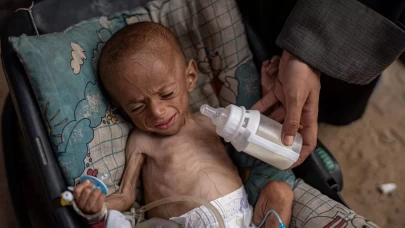 Gazze'de yetersiz beslenen çocuklar risk altında