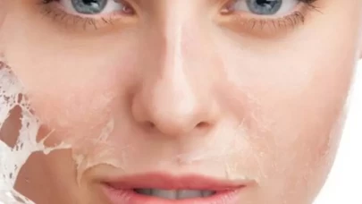 Cilt bariyerini güçlendirmenin püf noktaları