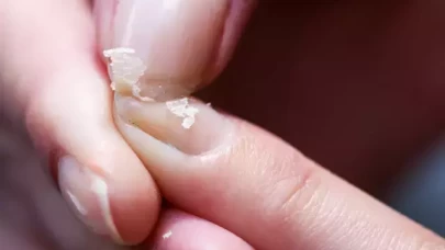 Kopan tırnaklara son! Tertemiz ışıl ışıl tırnaklar geliyor